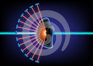 Focus ultrasound for treatment of neurological disease