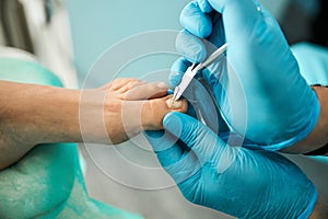 Focused photo on male hands holding nail clippers