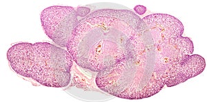 Foetal kidney cortex and medulla photo