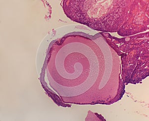 Follicle ovary chicken photo