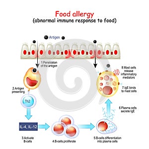 Food allergy. abnormal immune response to food