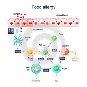 Food allergy. Inflammation of Intestine photo