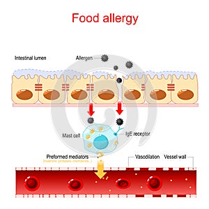 Food allergy and leaky gut