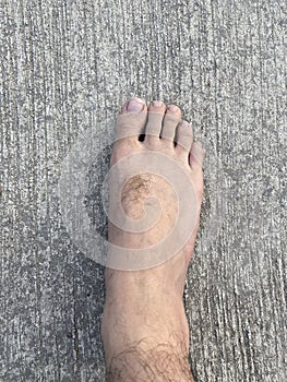 Foor on cement floor