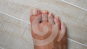 Foot