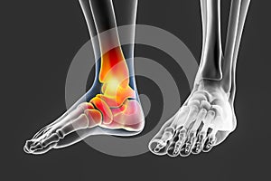 Foot and ankle pain, conceptual 3D illustration