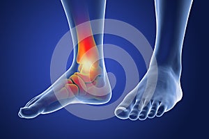 Foot and ankle pain, conceptual 3D illustration