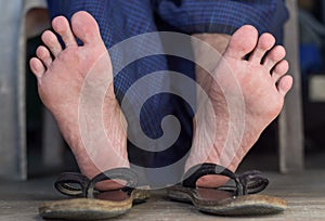 Foot of Asian man. Concept of foot care, pain and health