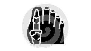 foot big toe bone gout glyph icon animation