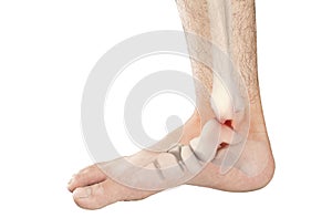 Foot bones pain