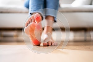 Foot Heel Pain And Callus Care Closeup photo
