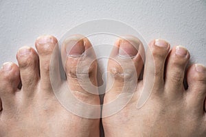 The foot and long nail toes on white concrete background.