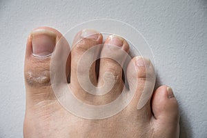 The foot and long nail toes on white concrete background.