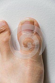 The foot and long nail toes on white concrete background