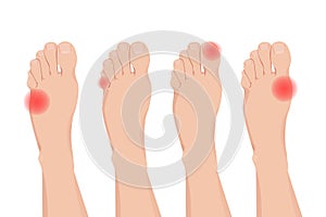 Foot pain and numb vector illustration design