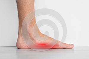 Foot pain because of strong flat feet also called pes planus or fallen arches.