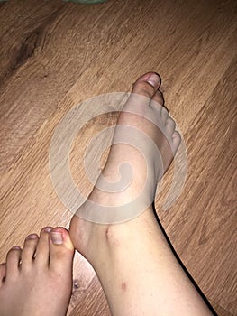 Foot pics