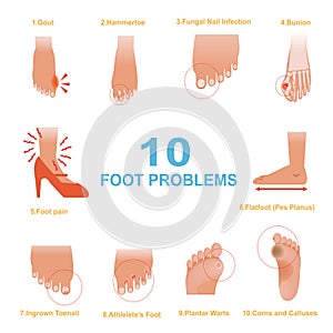 Foot Problems