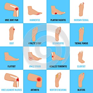 Foot Problems Flat Icons Set