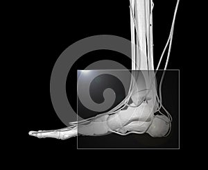 Foot X-ray