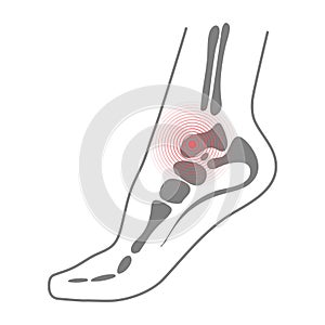 Foot Sole With Bones Illustration For Biomechanics, Footwear, Shoe Concepts, Medical, Health, Massage, Spa, Acupuncture