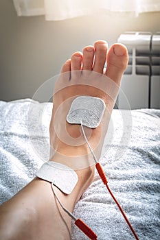 Foot on stretcher subjected to a medical treatment of electro stimulation with patches and electric wave