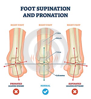 Foot supination and pronation vector illustration. Labeled medical scheme.