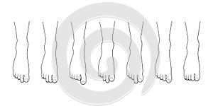 Foot toe shape types set. photo