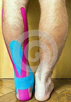 The foot with a wound covered with tape used in elastic therapeutic tape (Kinesio Taping).