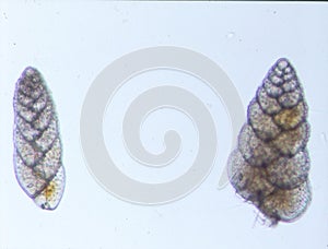 Foraminifera microorganisms from the sea