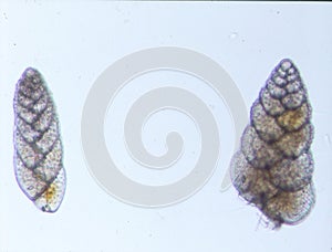 Foraminifera microorganisms from the sea photo