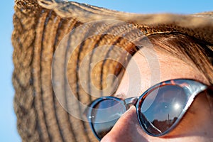 Forehead of a woman with freckles in direct sunlight, close-up view.