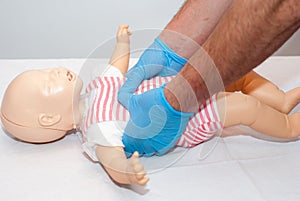 Foreign body airway, choking child