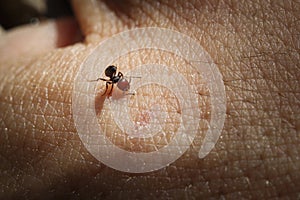 Formic on skin