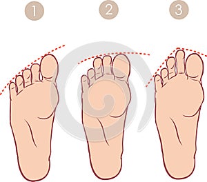 Formlessness of toes