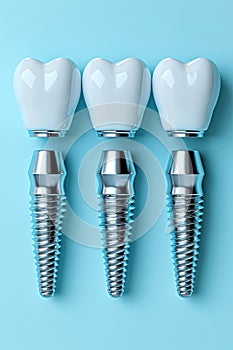 Four dental implants with crowns on a blue backdrop.