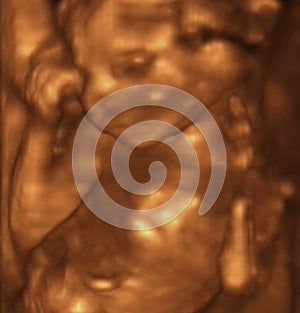 Fourth Month 3D Echography