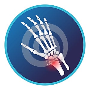 Fracture of distal radius with hand bone icon. Vector flat design for radiology orthopedic research hospital photo