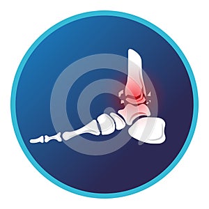 Fracture of the distal tibia and foot bone icon. Vector flat design for radiology orthopedic research hospital for body joints,