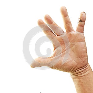 Fracture hand an external fixation a broken metal bones are inserted outside the patient`s body.Isolated white background