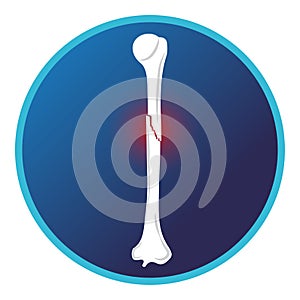 Fracture shaft of humerus bone icon. Vector flat design for radiology orthopedic research hospital