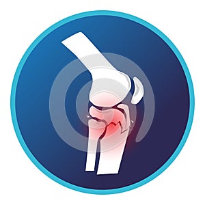 Fracture tibial plateau and knee icon. Vector flat design for radiology orthopedic research hospital