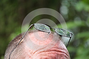 Freckled forehead with perched glasses