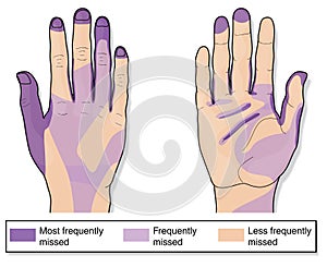 Frequently missed areas when cleaning hands