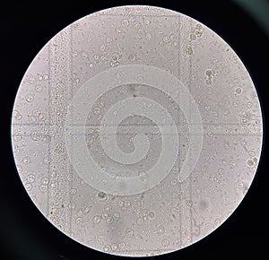 Fresh bacteria cell in urine sample