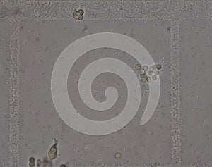 Fresh bacteria in urine analysis