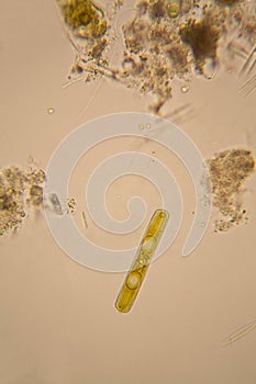 Pond water plankton and algae at the microscope. Diatoms photo