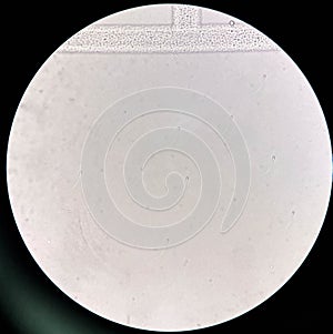 Fresh spermatozoa in urine sediment