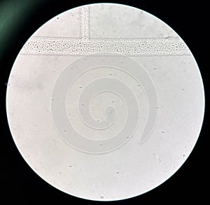 Fresh spermatozoa in urine sediment