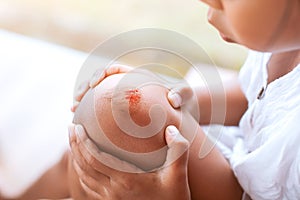 Fresh wound and blood from injured on child knee